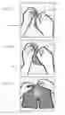 Fig. 08 - REMINDER SYSTEM AND METHOD FOR URINE COLLECTION