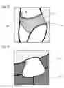 Fig. 09 - REMINDER SYSTEM AND METHOD FOR URINE COLLECTION