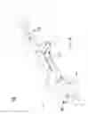 Fig. 06 - SIZING INSTRUMENT FOR A BODILY JOINT SUCH AS AN INTERVERTEBRAL DISC SPACE