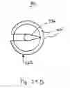 Fig. 20 - SIZING INSTRUMENT FOR A BODILY JOINT SUCH AS AN INTERVERTEBRAL DISC SPACE