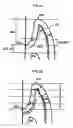Fig. 04 - GUM MASSAGER