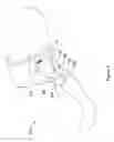 Fig. 04 - Temperature regulated compression brace