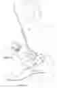 Fig. 04 - Foot brace for recuperation