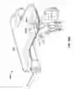 Fig. 12 - Hip distraction
