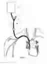 Fig. 02 - Pressure activated proximal valves