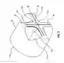 Fig. 04 - Pressure activated proximal valves