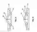 Fig. 08 - Pressure activated proximal valves