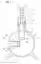 Fig. 04 - Apparatus for applying and removing closing means from an end portion of a tubular element and the use thereof in peritoneal dialysis