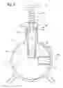 Fig. 06 - Apparatus for applying and removing closing means from an end portion of a tubular element and the use thereof in peritoneal dialysis