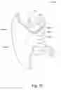 Fig. 17 - Breast cup