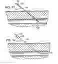 Fig. 07 - Catheter introducer system