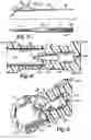 Fig. 03 - Hysteroscope Seal