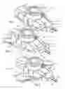 Fig. 02 - Stabilized implantable vascular access port
