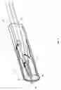 Fig. 03 - Aspiration thrombectomy catheter system, and associated methods