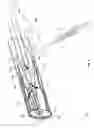 Fig. 05 - Aspiration thrombectomy catheter system, and associated methods