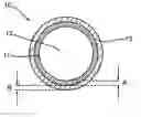 Fig. 01 - Implantable medical device with pharmacologically active ingredient