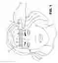 Fig. 02 - Cryogenic applicator for rejuvenating human skin and related method