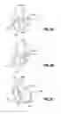 Fig. 12 - Multifunctional medical device assembly