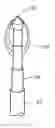 Fig. 01 - Electrosurgical method and systems for treating glaucoma