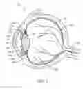 Fig. 02 - Electrosurgical method and systems for treating glaucoma