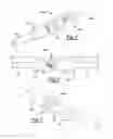 Fig. 05 - External fixation system