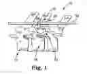 Fig. 02 - Spinal implant hooks and systems