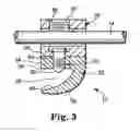 Fig. 04 - Spinal implant hooks and systems