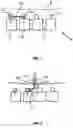 Fig. 02 - Spinal fusion using rods of shape memory material