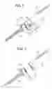 Fig. 03 - Instruments and methods for manipulating vertebra