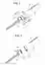 Fig. 03 - Instruments and methods for manipulating vertebra
