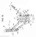 Fig. 14 - Instruments and methods for manipulating vertebra