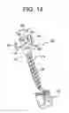 Fig. 16 - Instruments and methods for manipulating vertebra