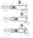 Fig. 07 - Orthopaedic device with locking barrel