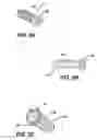 Fig. 06 - Spinal plate and drill guide