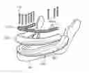 Fig. 01 - Supra-mucosal bone fixation apparatus and method