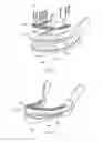 Fig. 02 - Supra-mucosal bone fixation apparatus and method