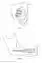 Fig. 04 - Supra-mucosal bone fixation apparatus and method