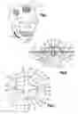 Fig. 02 - Method and apparatus for treatment of bones