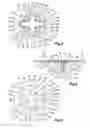 Fig. 03 - Method and apparatus for treatment of bones