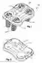 Fig. 02 - Resorbable anterior cervical plating system with screw retention mechanism