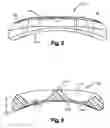 Fig. 04 - Resorbable anterior cervical plating system with screw retention mechanism