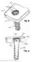Fig. 08 - Resorbable anterior cervical plating system with screw retention mechanism