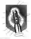 Fig. 01 - IMPLANT FOR ANCHORING IN BONES