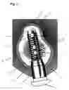 Fig. 02 - IMPLANT FOR ANCHORING IN BONES