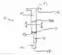 Fig. 01 - Internal pedicle insulator apparatus and method of use