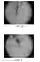 Fig. 04 - Self-drilling self-tapping bone screw