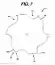 Fig. 07 - Modular tapered reamer for bone preparation and associated method