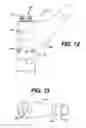 Fig. 12 - Modular tapered reamer for bone preparation and associated method