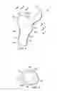 Fig. 09 - Method of preparing an acetabulum for receiving a head of a femoral prosthesis