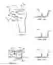 Fig. 12 - Method of preparing an acetabulum for receiving a head of a femoral prosthesis
